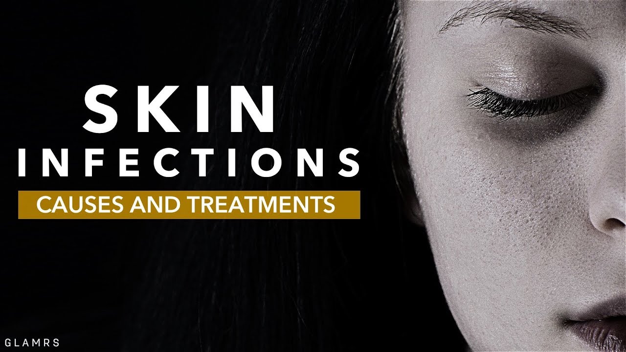 skin-infections-causes-and-treatments