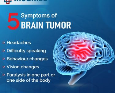 Brain Tumor and Its Treatment